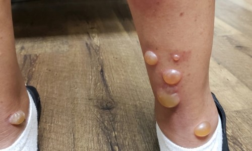 哺乳期十全大补丸吗网—知名的十全大补丸可以提高生孕网站,分享哺乳期可以吃十全大补丸会影响宝宝发音不标准吗知识